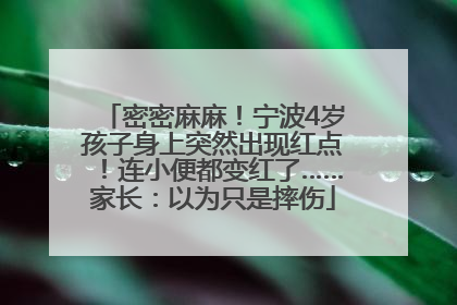 密密麻麻！宁波4岁孩子身上突然出现红点！连小便都变红了……家长：以为只是摔伤
