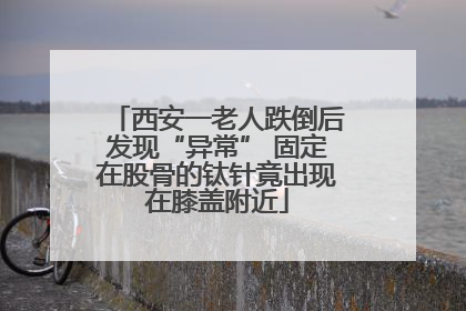 西安一老人跌倒后发现“异常” 固定在股骨的钛针竟出现在膝盖附近